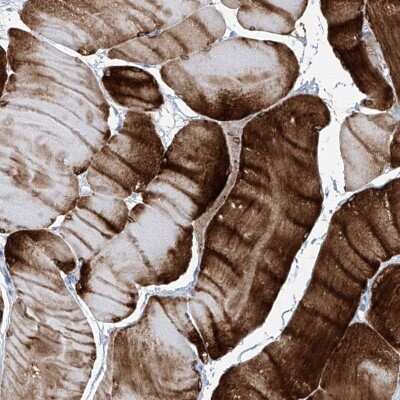 Immunohistochemistry-Paraffin: TXLNB Antibody [NBP2-33926]