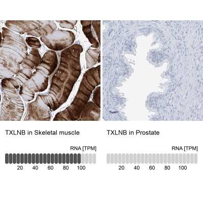 Immunohistochemistry-Paraffin: TXLNB Antibody [NBP2-33926]