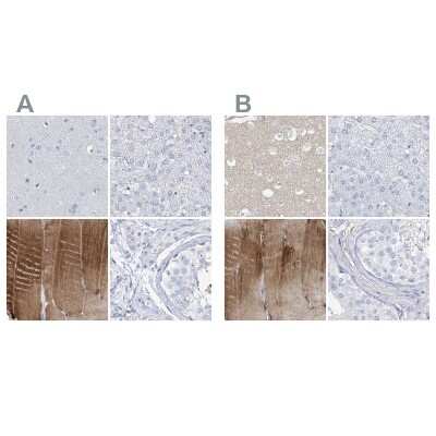 Immunohistochemistry-Paraffin: TXLNB Antibody [NBP2-33926]