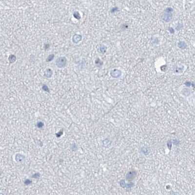 Immunohistochemistry-Paraffin: TXLNB Antibody [NBP2-33926]