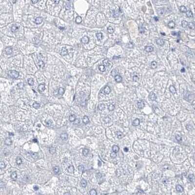 Immunohistochemistry-Paraffin: TXLNB Antibody [NBP2-33926]