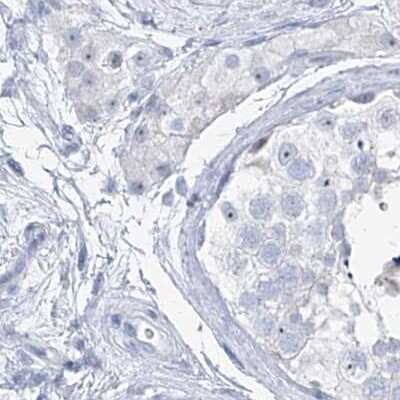 Immunohistochemistry-Paraffin: TXLNB Antibody [NBP2-33926]