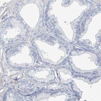 Immunohistochemistry-Paraffin: TXLNB Antibody [NBP2-33927]