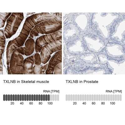 Immunohistochemistry-Paraffin: TXLNB Antibody [NBP2-33927]