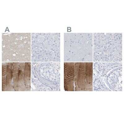 Immunohistochemistry-Paraffin: TXLNB Antibody [NBP2-33927]