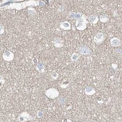 Immunohistochemistry-Paraffin: TXLNB Antibody [NBP2-33927]