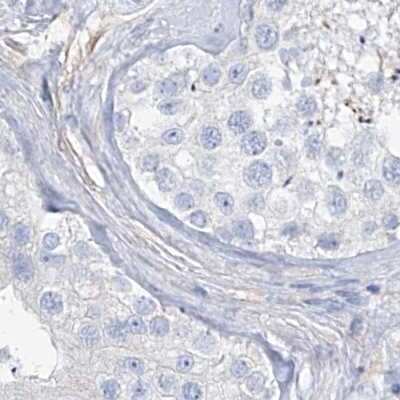 Immunohistochemistry-Paraffin: TXLNB Antibody [NBP2-33927]