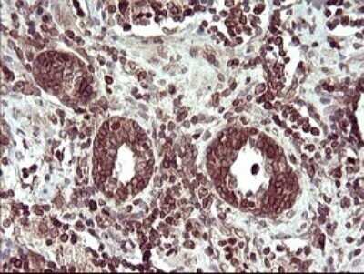 Immunohistochemistry: TXNDC Antibody (OTI3H5) - Azide and BSA Free [NBP2-74725]