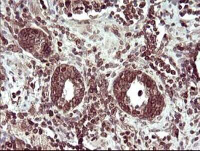 Immunohistochemistry: TXNDC Antibody (OTI3H5) [NBP2-46143]