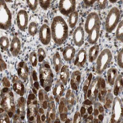Immunohistochemistry-Paraffin: TXNDC10 Antibody [NBP1-92550]