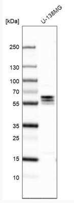 Western Blot: TXNDC10 Antibody [NBP1-92550]