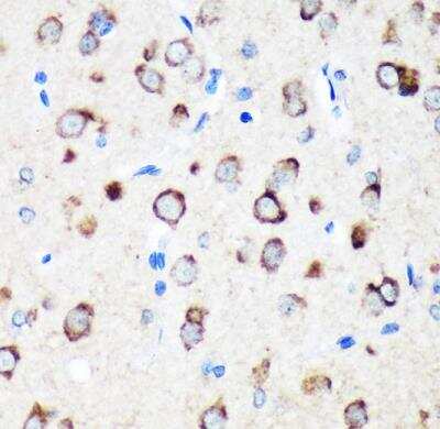 Immunohistochemistry-Paraffin: TXNDC12 Antibody - Azide and BSA Free [NBP2-93457]