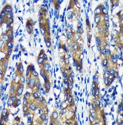 Immunohistochemistry-Paraffin: TXNDC12 Antibody - Azide and BSA Free [NBP2-93457]