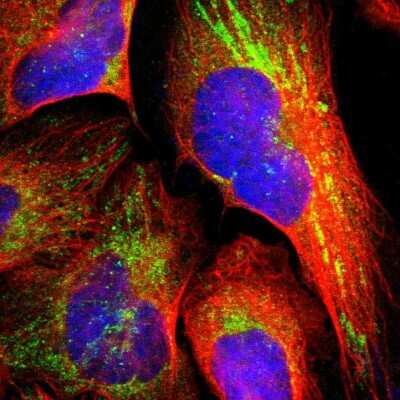 Immunocytochemistry/ Immunofluorescence: TXNDC16 Antibody [NBP1-93591]