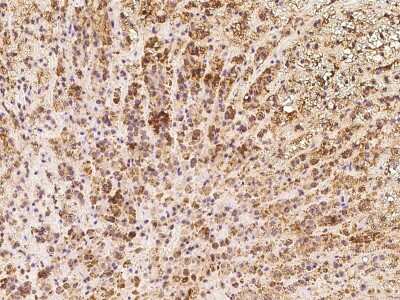 Immunohistochemistry-Paraffin: TXNDC16 Antibody [NBP2-98557]