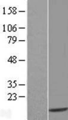 Western Blot: Thioredoxin-like 5/TRP14/TXNDC17 Overexpression Lysate [NBL1-17469]