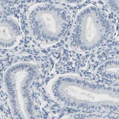 Immunohistochemistry-Paraffin: TXNDC2 Antibody [NBP1-80724]