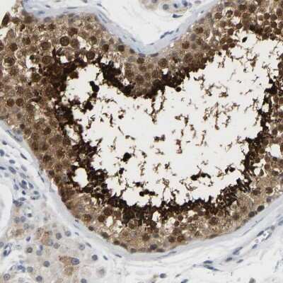 Immunohistochemistry-Paraffin: TXNDC2 Antibody [NBP1-80724]
