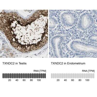 Immunohistochemistry-Paraffin: TXNDC2 Antibody [NBP1-80724]