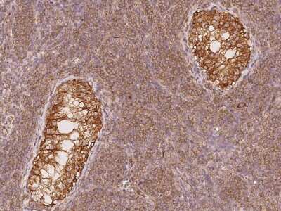 Immunohistochemistry-Paraffin: TXNDC2 Antibody [NBP2-98198]