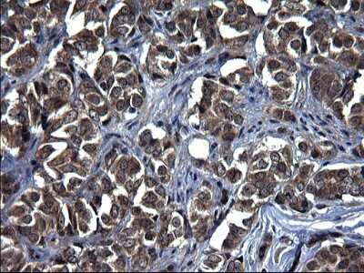 Immunohistochemistry-Paraffin: TXNDC5 Antibody (OTI2E6) [NBP2-46256]