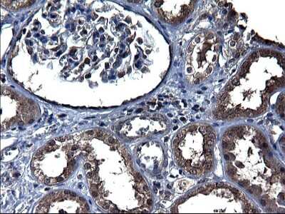 Immunohistochemistry-Paraffin: TXNDC5 Antibody (OTI2E6) [NBP2-46256]