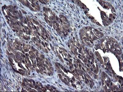 Immunohistochemistry-Paraffin: TXNDC5 Antibody (OTI2E6) [NBP2-46256]