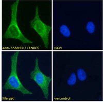 Immunocytochemistry/ Immunofluorescence: TXNDC5 Antibody [NB100-1452]
