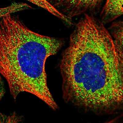 Immunocytochemistry/ Immunofluorescence: TXNDC5 Antibody [NBP2-13497]
