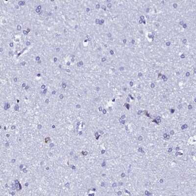 Immunohistochemistry-Paraffin: TXNDC5 Antibody [NBP2-13496]