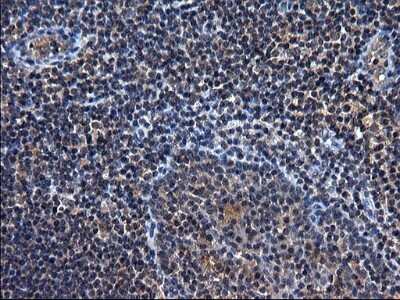 Immunohistochemistry: TXNDC5 Antibody (OTI2E6) - Azide and BSA Free [NBP2-74726]
