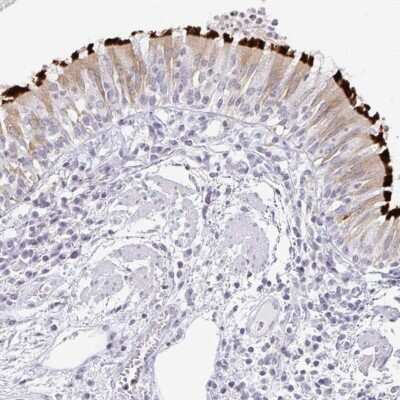 Immunohistochemistry: TXNDC6 Antibody [NBP2-48802]
