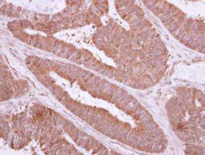 Immunohistochemistry-Paraffin: TXNDC6 Antibody [NBP2-15152]