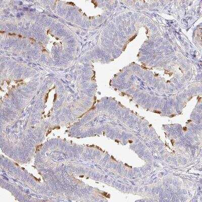 Immunohistochemistry-Paraffin: TXNDC6 Antibody [NBP2-48719]