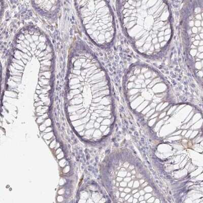 Immunohistochemistry-Paraffin: TXNDC6 Antibody [NBP2-48719]