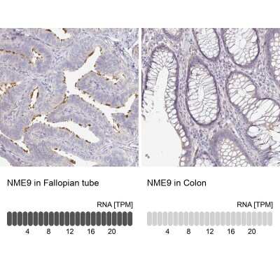 Immunohistochemistry-Paraffin: TXNDC6 Antibody [NBP2-48719]