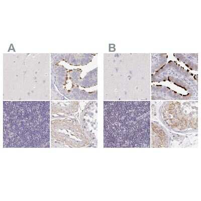 Immunohistochemistry-Paraffin: TXNDC6 Antibody [NBP2-48719]