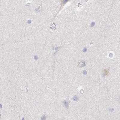 Immunohistochemistry-Paraffin: TXNDC6 Antibody [NBP2-48719]