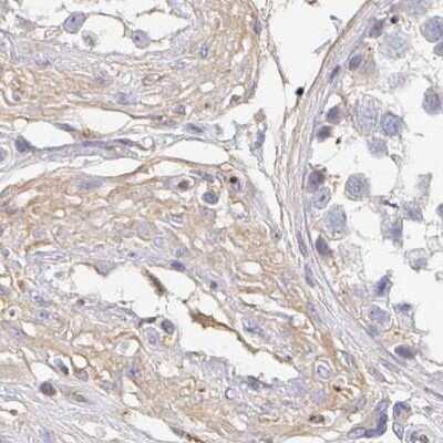 Immunohistochemistry-Paraffin: TXNDC6 Antibody [NBP2-48719]