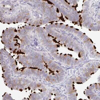 Immunohistochemistry-Paraffin: TXNDC6 Antibody [NBP2-48802]