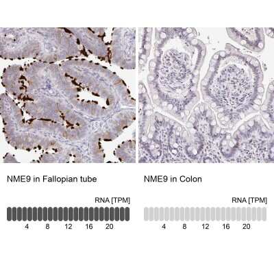 Immunohistochemistry-Paraffin: TXNDC6 Antibody [NBP2-48802]