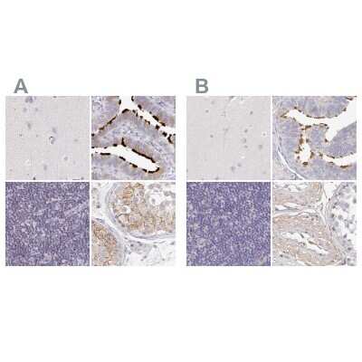 Immunohistochemistry-Paraffin: TXNDC6 Antibody [NBP2-48802]
