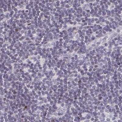 Immunohistochemistry-Paraffin: TXNDC6 Antibody [NBP2-48802]