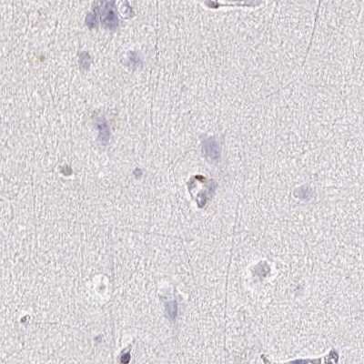 Immunohistochemistry-Paraffin: TXNDC6 Antibody [NBP2-48802]
