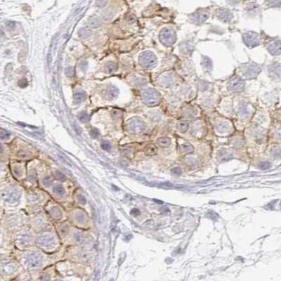 Immunohistochemistry-Paraffin: TXNDC6 Antibody [NBP2-48802]