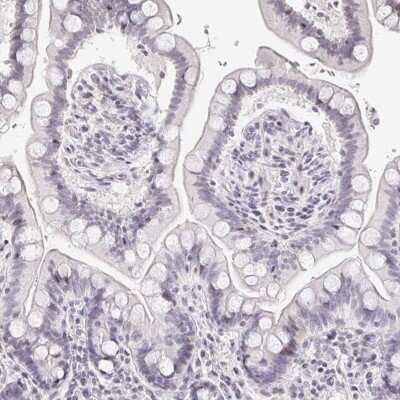 Immunohistochemistry-Paraffin: TXNDC6 Antibody [NBP2-48802]