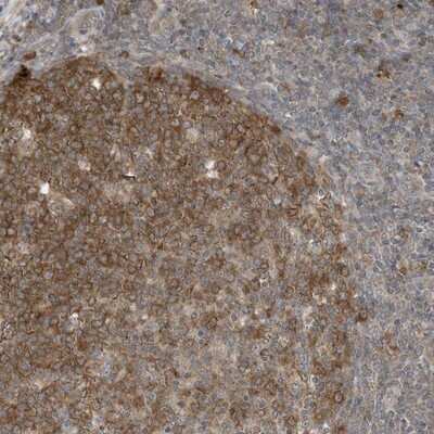 Immunohistochemistry-Paraffin: TXNDC9 Antibody [NBP1-89052]