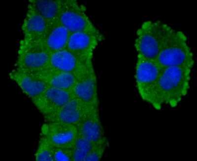 Immunocytochemistry/ Immunofluorescence: TXNIP Antibody (JM60-35) [NBP2-75692]
