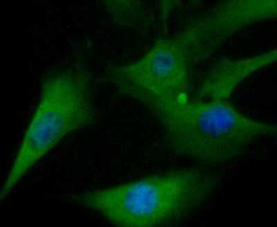 Immunocytochemistry/ Immunofluorescence: TXNIP Antibody (JM60-35) [NBP2-75692]