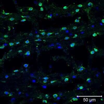 Immunohistochemistry: TXNIP Antibody (JY2) - Azide and BSA Free [NBP2-81001]